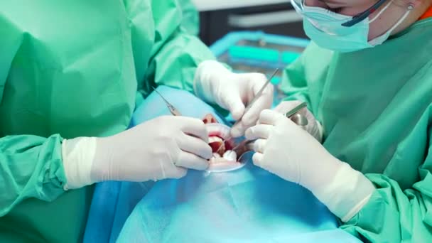 Zamknąć Zespół Chirurgów Stomatologicznych Wykonuje Operację Zębie Nowoczesnej Klinice Dentystycznej — Wideo stockowe