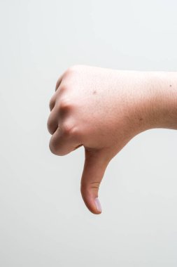 El başparmağı indiriyor, hayal kırıklığı sembolü oluşturuyor.