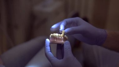diş hekimi elinde çene modeli