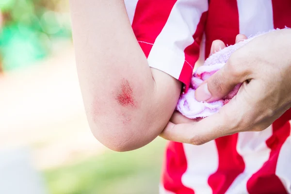 Niño pequeño con herida en el brazo sangrante cerca del codo Fotos de stock