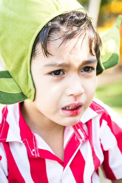 Little boy Bleeding at the mouth and crying — Stock Image Little boy Bleeding at the mouth and crying Stock Image