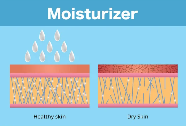 Ενυδατικό Ξηρό Δέρμα Και Υγιές Δέρμα Διανυσματικός Σχεδιασμός — Διανυσματικό Αρχείο