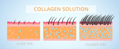 Kolajen ve Elastin, Koruma Cildi ve dolgun vektör tasarımı