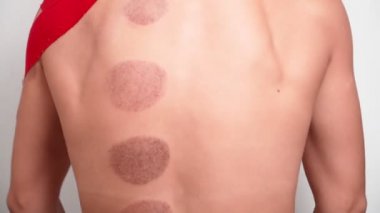 Yaralı omzunda Kinesio bandı olan atletik bir kadın kupa terapisi prosedüründen sonra sırtını geriyor. Spor yaralarının tedavisi. Sırt ağrısı. Beyaz arkaplanda izole
