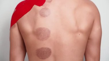 Yaralı omzunda Kinesio bandı olan atletik bir kadın kupa terapisi prosedüründen sonra sırtını geriyor. Spor yaralarının tedavisi. Sırt ağrısı. Beyaz arkaplanda izole