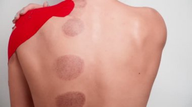 Yaralı omzunda Kinesio bandı olan atletik bir kadın kupa terapisi prosedüründen sonra sırtını geriyor. Spor yaralarının tedavisi. Sırt ağrısı. Beyaz arkaplanda izole