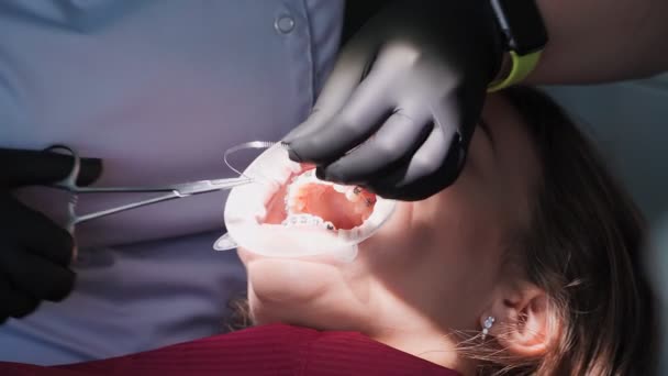 Mujer Dentista Guantes Médicos Trabaja Con Una Paciente Una Consulta — Vídeos de Stock