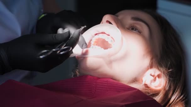 医療用手袋の女性歯科医歯科事務所で患者の女の子と仕事をします ブレースの設置と歯のアライメント 医療と医学の概念 閉じろ — ストック動画