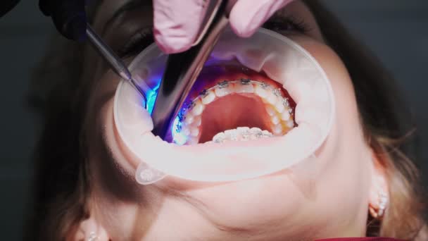 Mujer Dentista Guantes Médicos Con Dispositivo Ultravioleta Mano Trabaja Con — Vídeos de Stock
