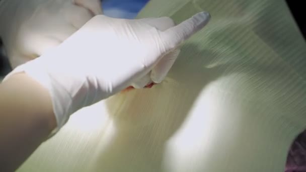 Tandarts Handen Met Assistent Witte Handschoenen Behandelen Vrouw Tanden Met — Stockvideo