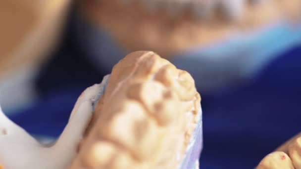 Скульптурні пластичні зубні протези в стоматології. Протезування зубів. Щелепи для 3D сканування — стокове відео