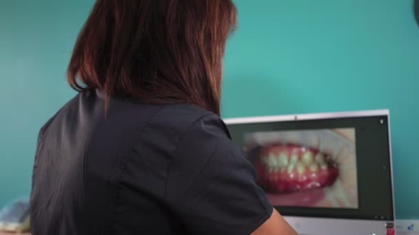 Mulher dentista profissional discute plano de tratamento com paciente no computador — Vídeo de Stock