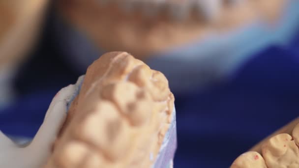 Prótesis plásticas esculpidas en odontología. Prótesis dentales. Mandíbulas para escaneo 3D — Vídeo de stock