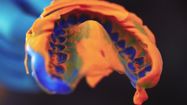 Il dentista in guanti medici mostra l'impressione di denti per installazione di impiallacciature — Video Stock