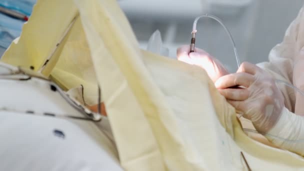 Δύο γυναίκες χειρουργοί εκτελούν οφθαλμολογική χειρουργική με μικροσκόπιο και ιατρικά όργανα — Αρχείο Βίντεο