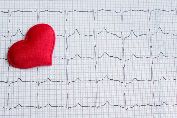 red heart on a cardiogram. top view, close-up, horizontal photo. Concept - treatment, timely diagnosis. Health protection, timely diagnosis will save a person from the consequences of a heart attack.