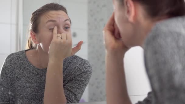 여인은 눈꺼풀에 있는 치료용 연고 염증을 진단 한다 — 비디오