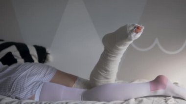 Kırık bacağı ve kompozit çorabı olan bir kadın sabahın köründe evin yatağında yatıyor.