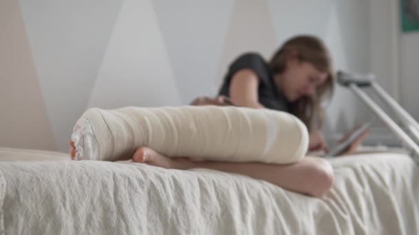 Eine Frau liegt mit gebrochenem Bein in Gips auf der Couch. — Stockvideo