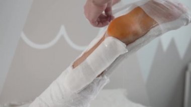 Doktor bacağında bandaj yarası açar, erkek elleri ameliyat yerini sarar..