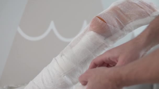 Närbild av patientens ben under bandageförband — Stockvideo