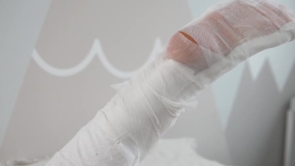 Arzt bindet Patienten nach Operation Bein mit elastischem Verband — Stockvideo