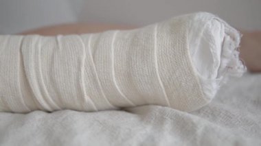 Bacağında kocaman bir yara bandı olan uyuyan bir kadının yakın çekimi.