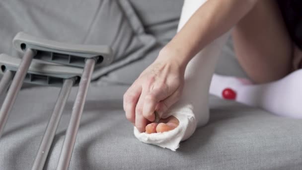 Жінка розвиває оніміння від гіпсових пальців ніг — стокове відео