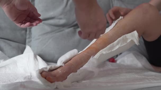 Um homem ajuda uma mulher a remover um gesso de uma perna inchada e sem vida em casa. — Vídeo de Stock