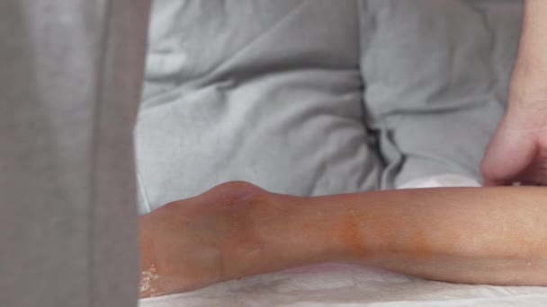 石膏や手術をした後の脚のケア — ストック動画