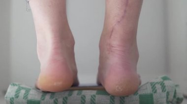 Bacağında yara olan bir kadın aşillerini evde gerer..