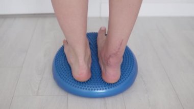 Aşil yırtılması sonrası rehabilitasyon.,