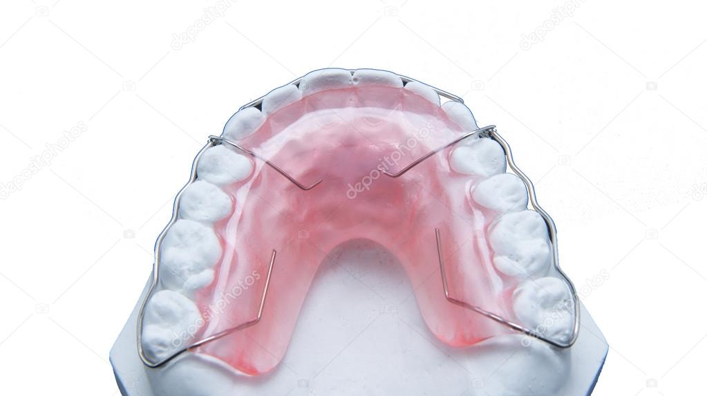 Retainer and brace with white fake gum