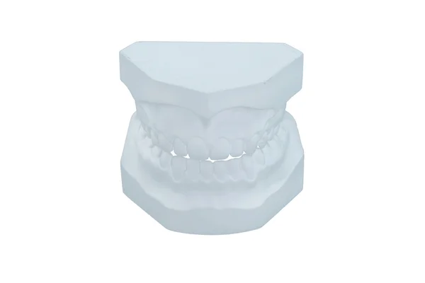 Dental plaster cast — Stock Photo, Image