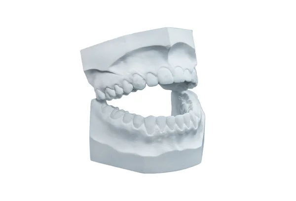 Dental plaster cast — Stock Photo, Image