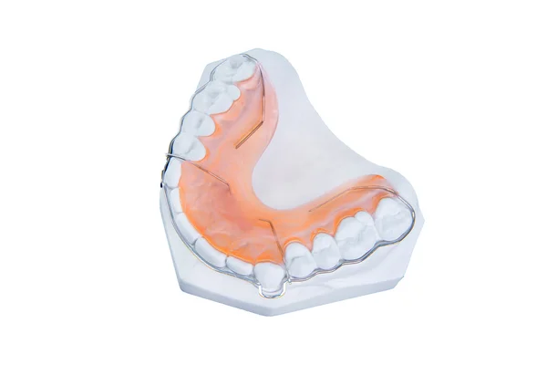 Retainer and brace with  gum — Stock Photo, Image