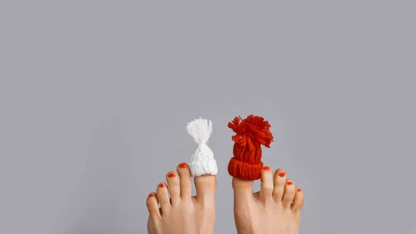 Lustige Verspielte Weibliche Füße Mit Kleiner Strickmütze Auf Großen Zehen — Stockfoto