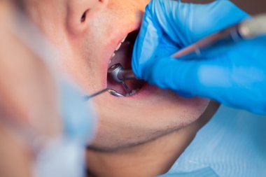 Diş hekimi tedavi hastaların diş dişçi içinde.