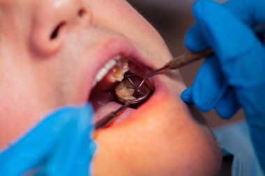 Diş hekimi tedavi hastaların diş dişçi içinde.