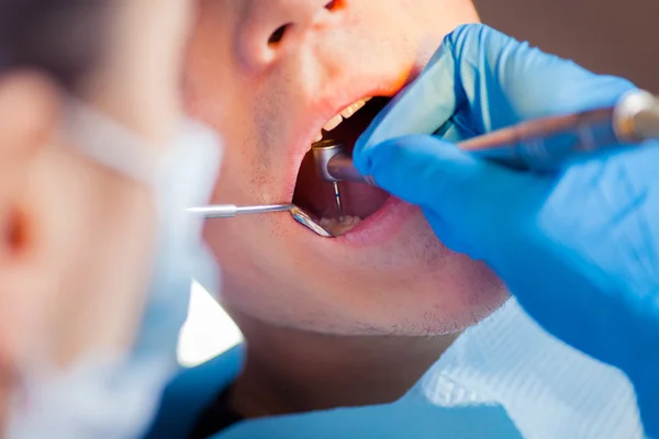 Zahnarzt Behandlung eines Patienten Zähne beim Zahnarzt. — Stockfoto