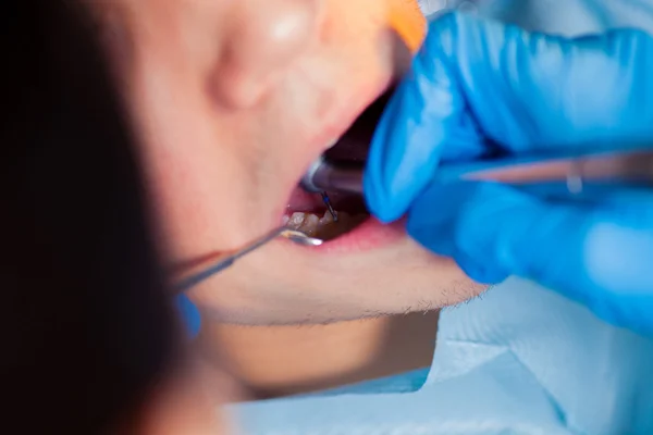 Zahnarzt Behandlung eines Patienten Zähne beim Zahnarzt. — Stockfoto