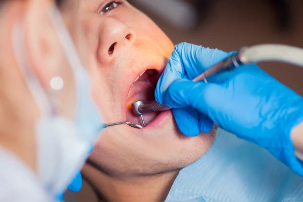 Mann lässt Zähne beim Zahnarzt untersuchen — Stockfoto