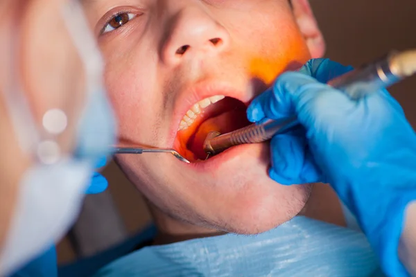 Zahnarzt Behandlung eines Patienten Zähne beim Zahnarzt. — Stockfoto