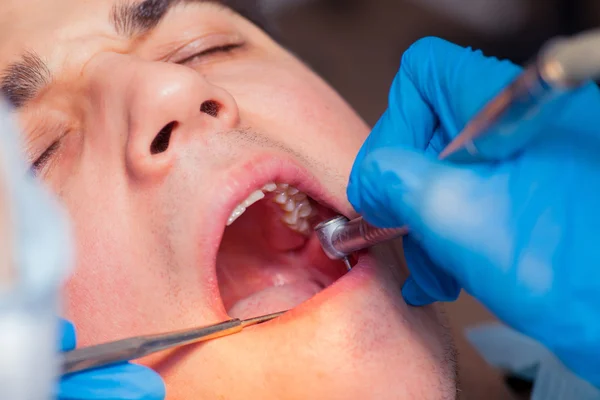 Zahnarzt Behandlung eines Patienten Zähne beim Zahnarzt. — Stockfoto