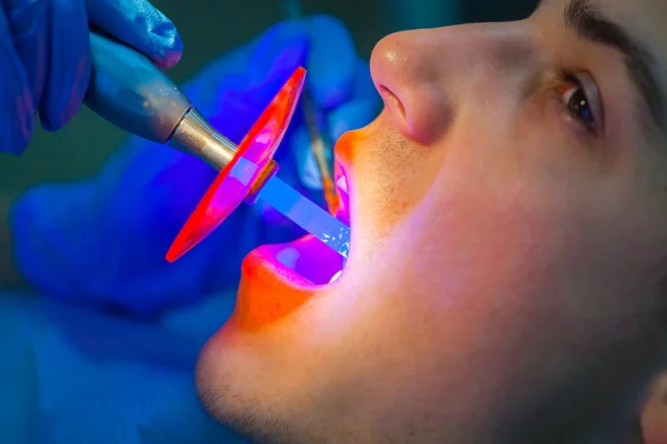 Zahnarzt UV-Licht Ausrüstung. Zahnbehandlung. Männer — Stockfoto