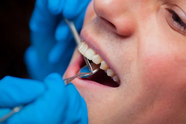 Dentist treatment a patients teeth in the dentist. — Stock Photo, Image