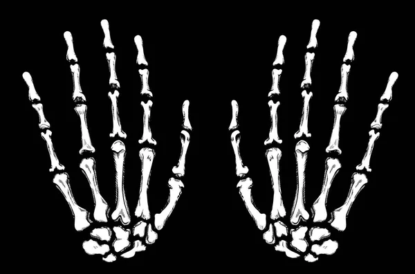 Skelett Mänsklig Hand Svart Bakgrund — Stock vektor