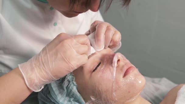 美容師は黒い斑点やにきびの顔を浄化します。美容室. — ストック動画