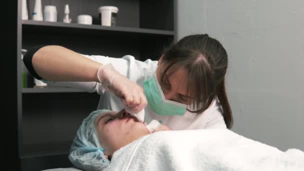 Kosmetologen rengör ansiktet på svarta fläckar från näsan med fingrarna. — Stockvideo