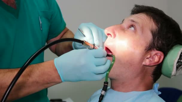 Reparar os dentes do paciente — Vídeo de Stock